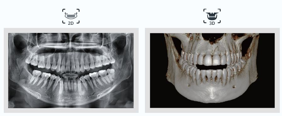 CBCT in Kyle Buda TX - Dentist at Plum Creek Kyle