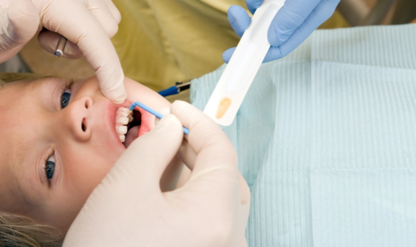 benefits of fluoride treatments for children and adults