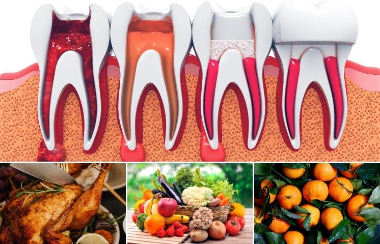 role of nutrition in root canal recovery